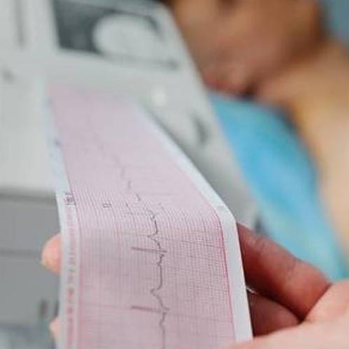 Electrocardiogram (ECG)