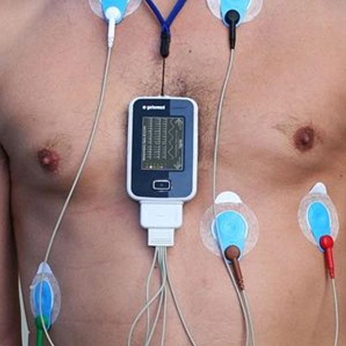 Ambulatory electrocardiogram (ECG) test