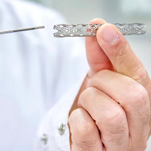 Angioplasty and stent placement