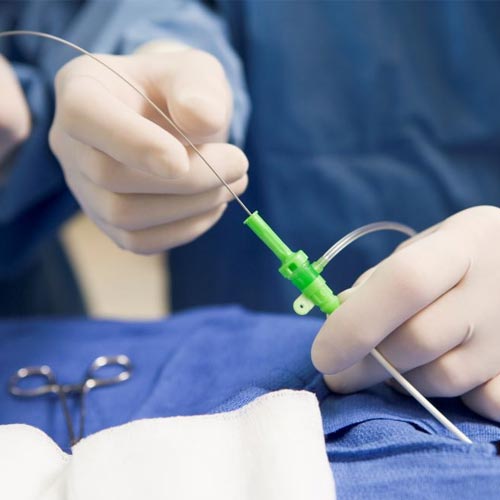 Cardiac catheterisation