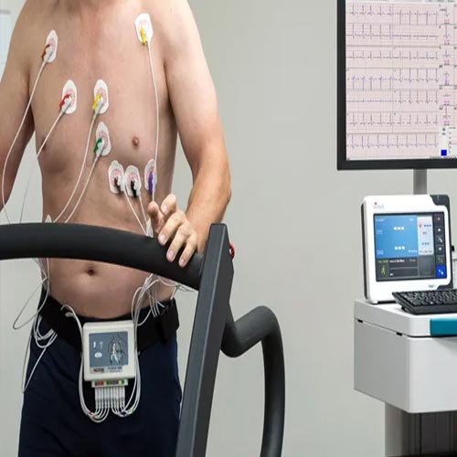 Cardiac stress test (stress ECG)
