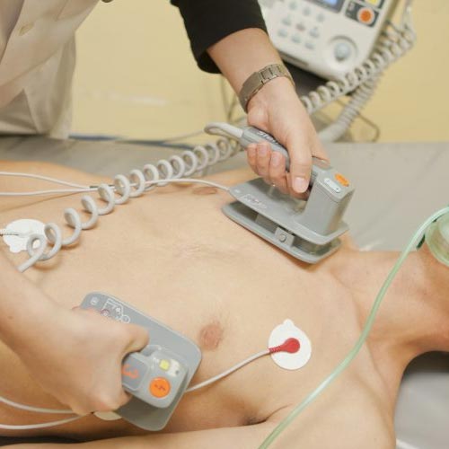 Cardioversion